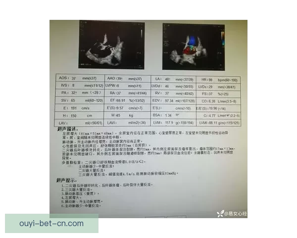 勇士伤情最新:霍福德波斯特康复顺利下周复查结果可期 勇士伤情最新:霍福德波斯特康复顺利下周复查结果可期